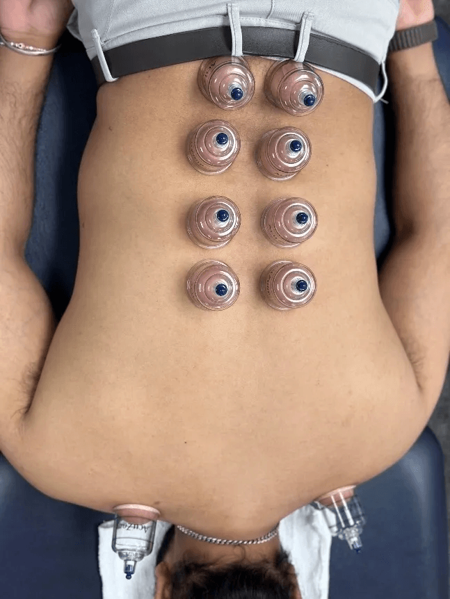 imgi_1_Physical-therapy-in-Herndon-b901f16