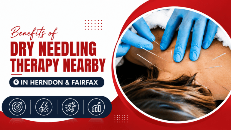 Dry Needling Therapy