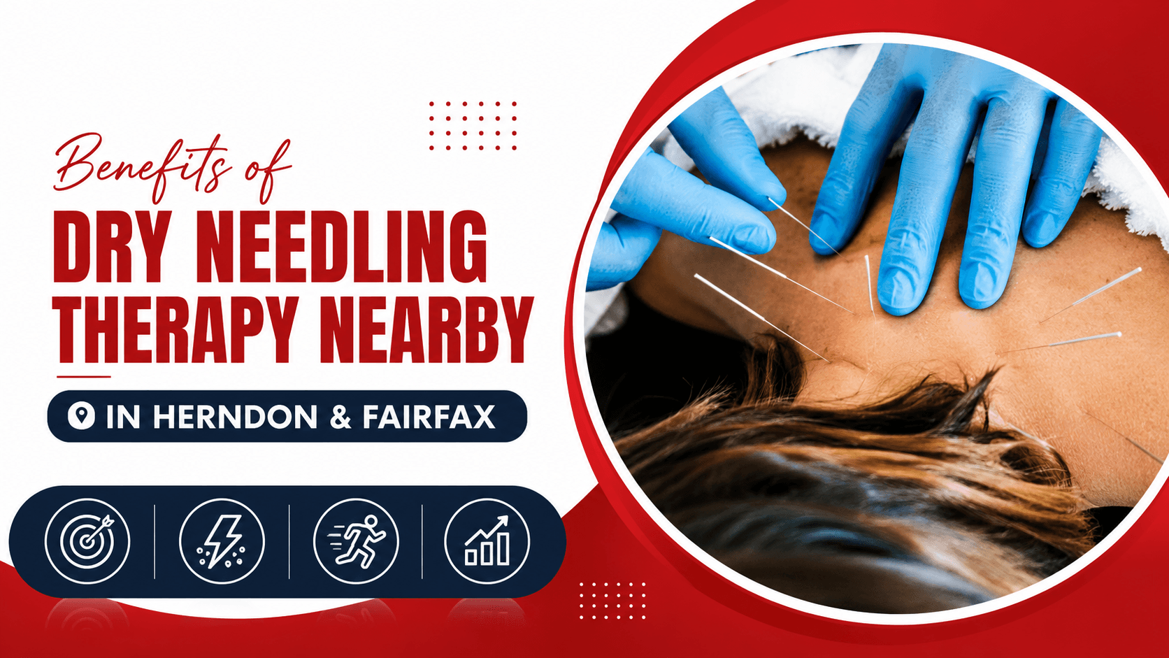 Why Herndon Patients Are Choosing Dry Needling for Muscle Pain and Recovery