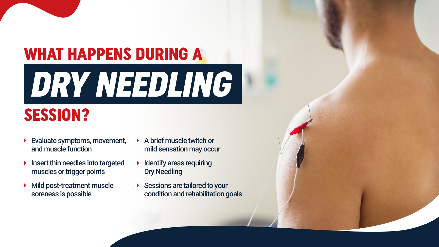 dry needling therapy near me